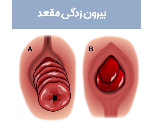 عکس باباسیل خارجی