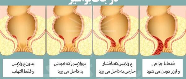 عکس باباسیل خارجی