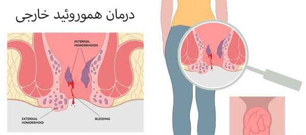 عکس باباسیل خارجی