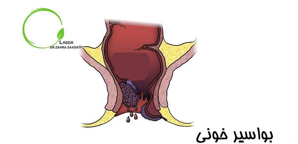 عکس باباسیل خارجی