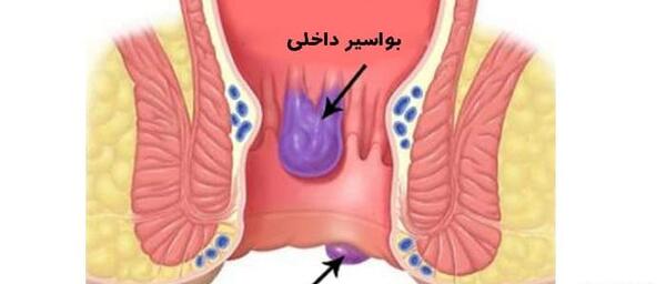 عکس باباسیل خارجی