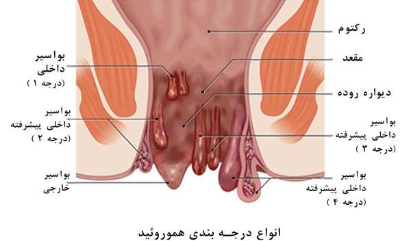 عکس باباسیل خارجی