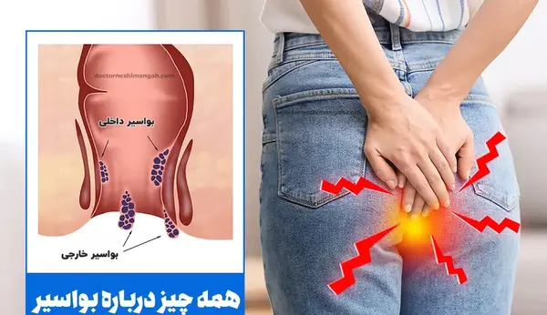 عکس باباسیل خارجی