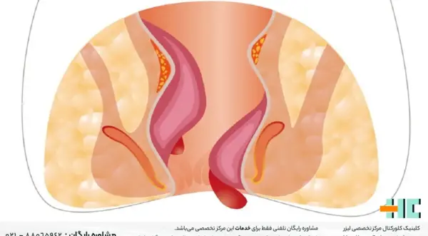 عکس باباسیل خارجی