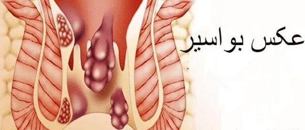 عکس باباسیل خارجی