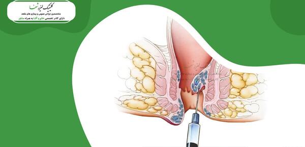 عکس باباسیل خارجی