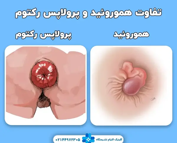 عکس باباسیل خارجی