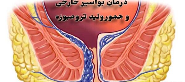 عکس باباسیل خارجی