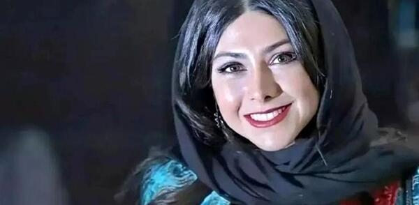 عکس های آزاده صمدی قبل از عمل بینی