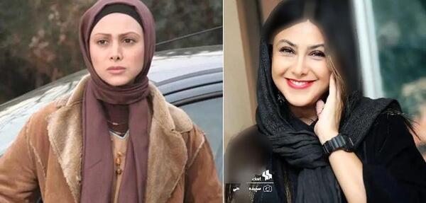 عکس های آزاده صمدی قبل از عمل بینی