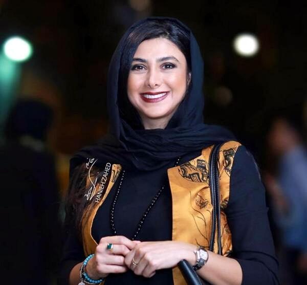 عکس های آزاده صمدی قبل از عمل بینی