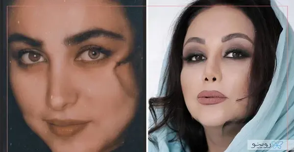 عکس های آزاده صمدی قبل از عمل بینی
