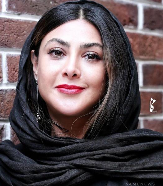 عکس ازاده صمدی قبل عمل