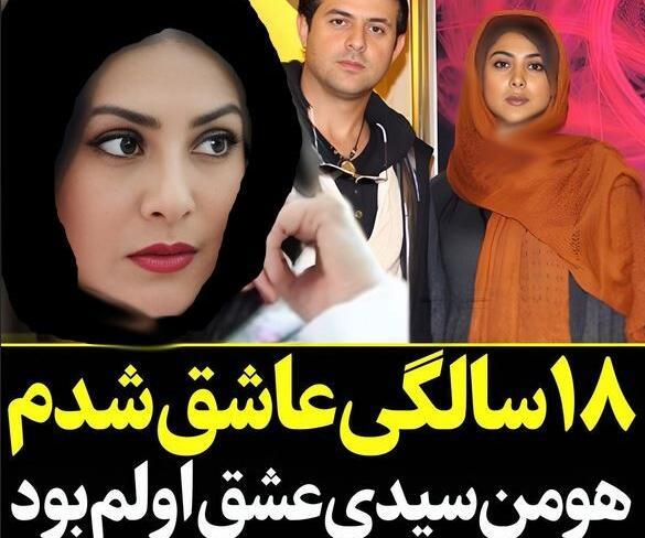 عکس ازاده صمدی قبل عمل