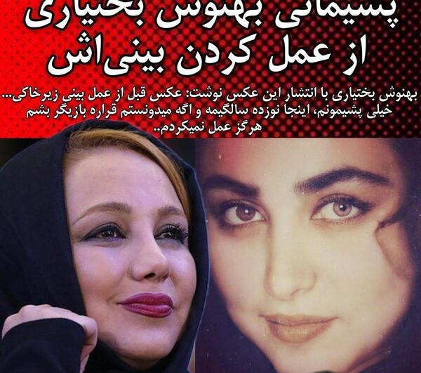 عکس ازاده صمدی قبل عمل