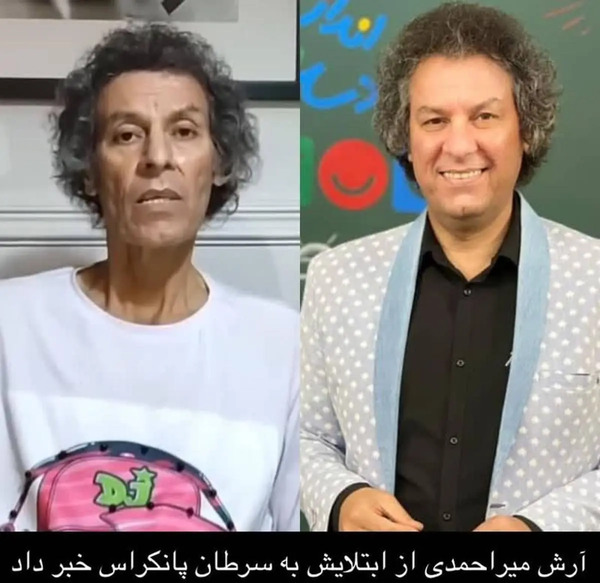 عکس سرطانی آرش میر احمدی