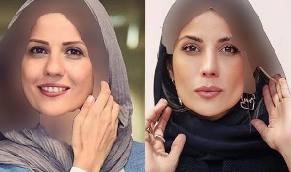عکس جدید سارا بهرامی بعد از عمل بینی