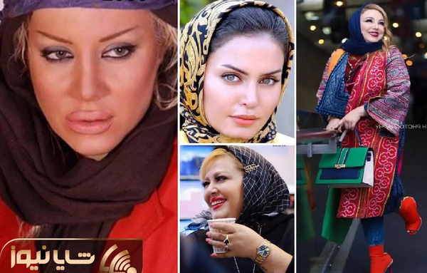 عکس جدید سارا بهرامی بعد از عمل بینی