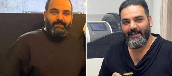 عکس احسان علیخانی بدون مو