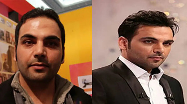 عکس احسان علیخانی بدون مو