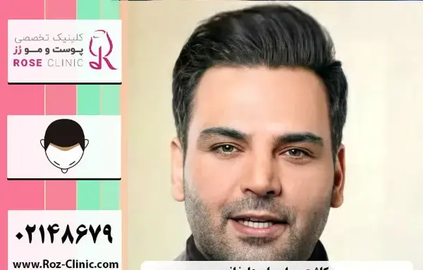 عکس احسان علیخانی بدون مو