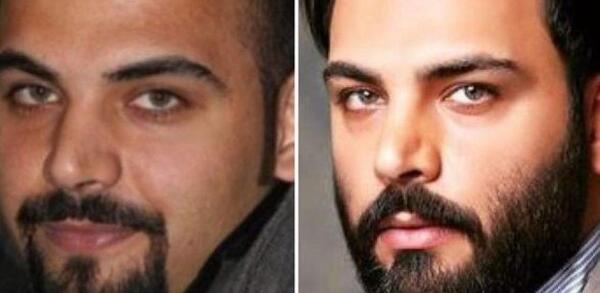 عکس احسان علیخانی بدون مو