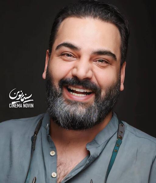 عکس احسان علیخانی قبل از عمل زیبایی