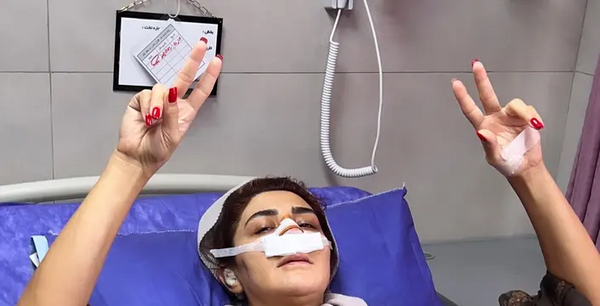 عکس احسان علیخانی قبل عمل بینی