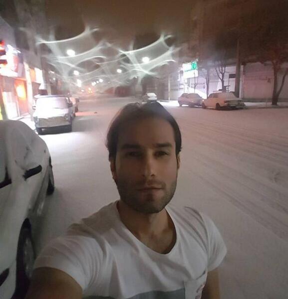 عکس مهدی احمدوند قبل از عمل