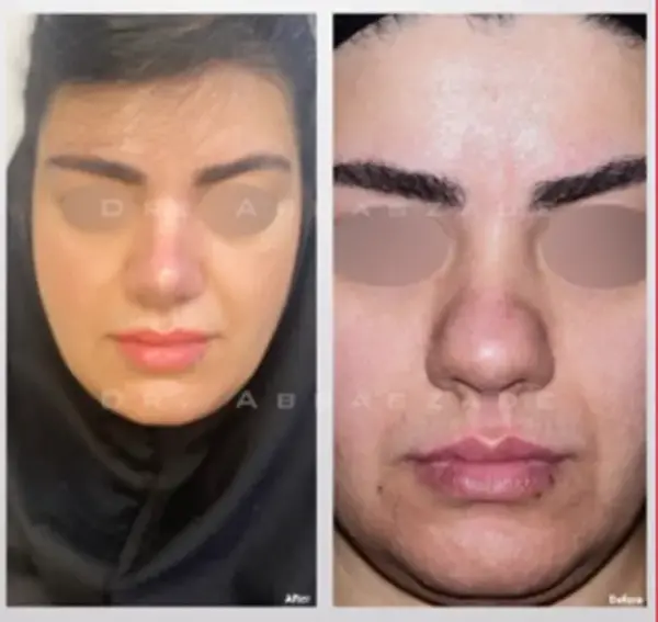 عکس ابوالفضل عباس زاده