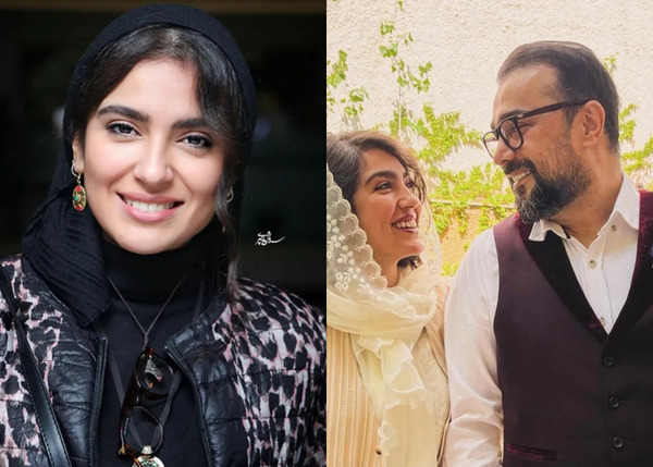عکس سپند امیر سلیمانی قبل از عمل بینی