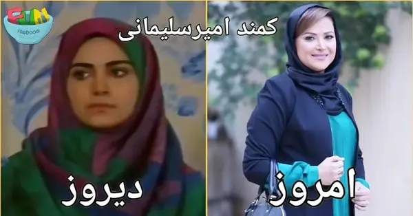 عکس کمند امیر سلیمانی قبل از عمل بینی