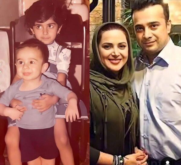 عکس کمند امیر سلیمانی قبل از عمل بینی