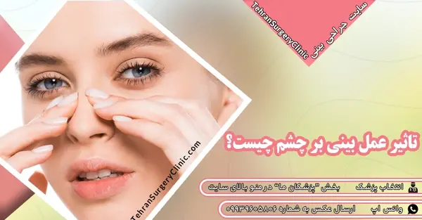 عکس فاطمه حسینی قبل از عمل زیبایی