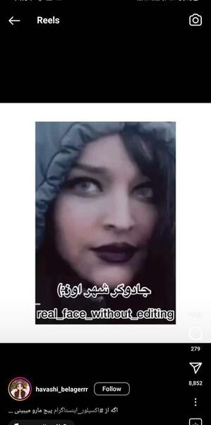 عکس محدثه هنرمند قبل عمل