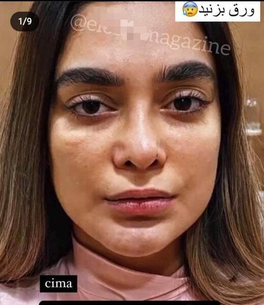 عکس های قبل عمل محدثه هنرمند