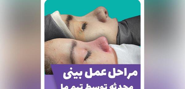عکس های قبل عمل محدثه هنرمند