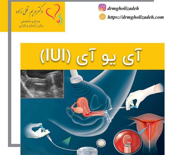 عکس دکتر مریم قلی زاده