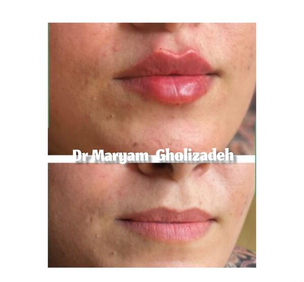 عکس دکتر مریم قلی زاده