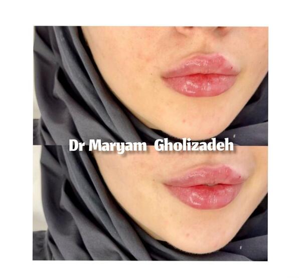 عکس دکتر مریم قلی زاده