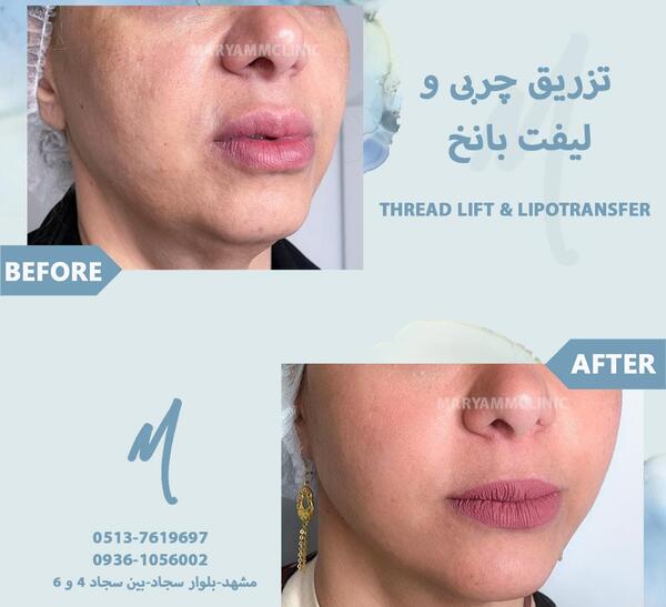 عکس دکتر مریم عزیزی بندرعباس