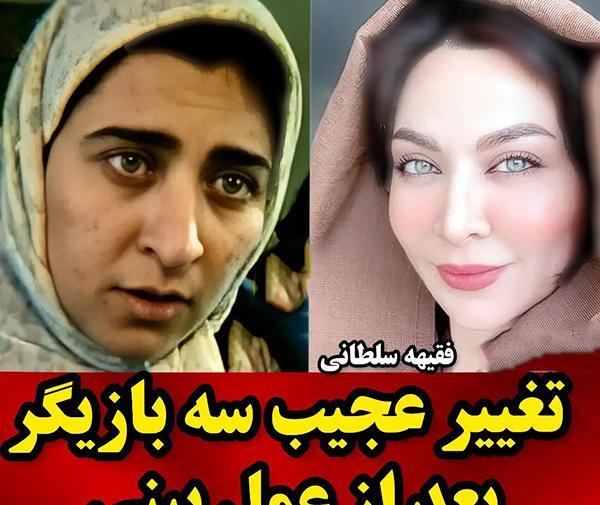 عکس مریم سلطانی قبل از عمل بینی