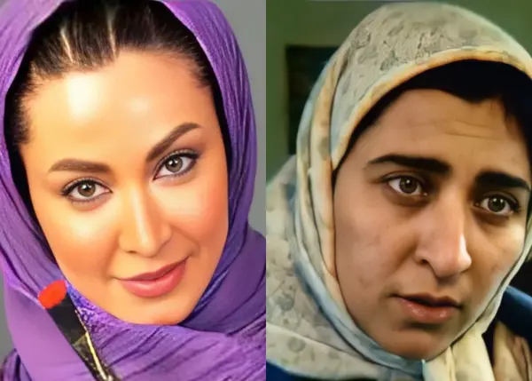 عکس مریم سلطانی قبل از عمل بینی