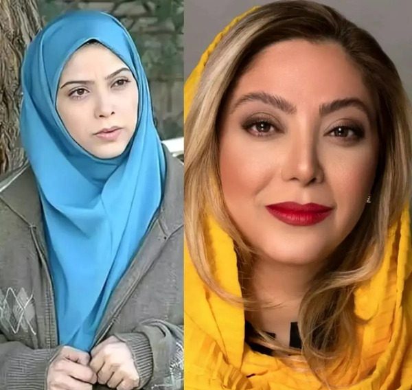 عکس مریم سلطانی قبل از عمل بینی