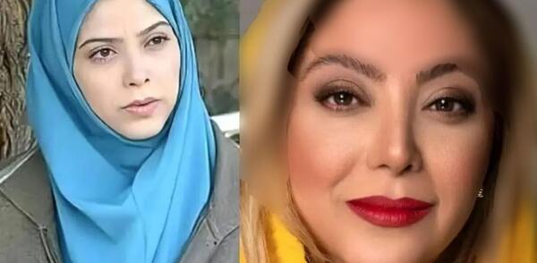 عکس مریم سلطانی قبل از عمل بینی