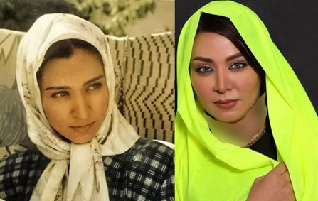 عکس مریم سلطانی قبل از عمل بینی