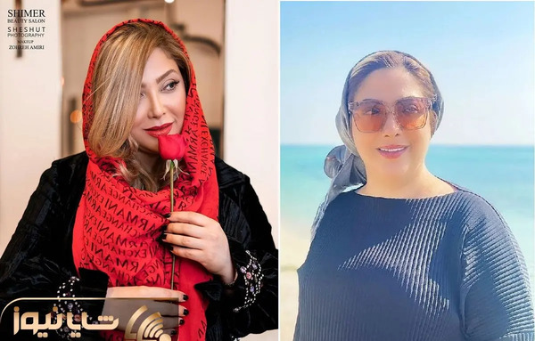 عکس مریم سلطانی قبل از عمل بینی