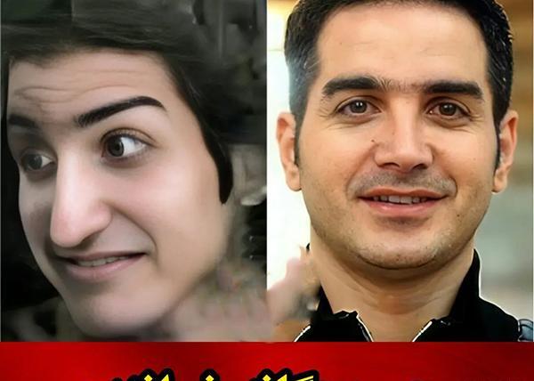 عکس مریم سلطانی قبل از عمل بینی