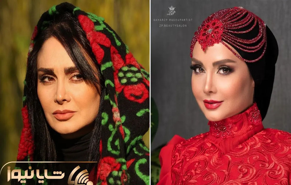 عکس مریم خدارحمی قبل از عمل زیبایی
