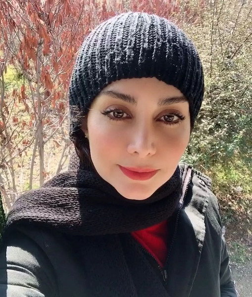 عکس مریم خدارحمی قبل از عمل زیبایی